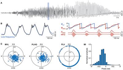 Assessing Epileptogenicity Using Phase-Locked High Frequency Oscillations: A Systematic Comparison of Methods